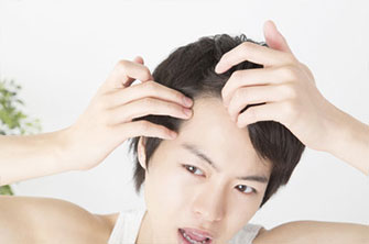 AGAを治したい男性