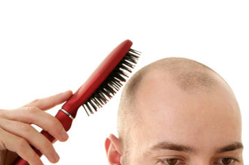 頭皮へのダメージ