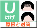 Uはげ